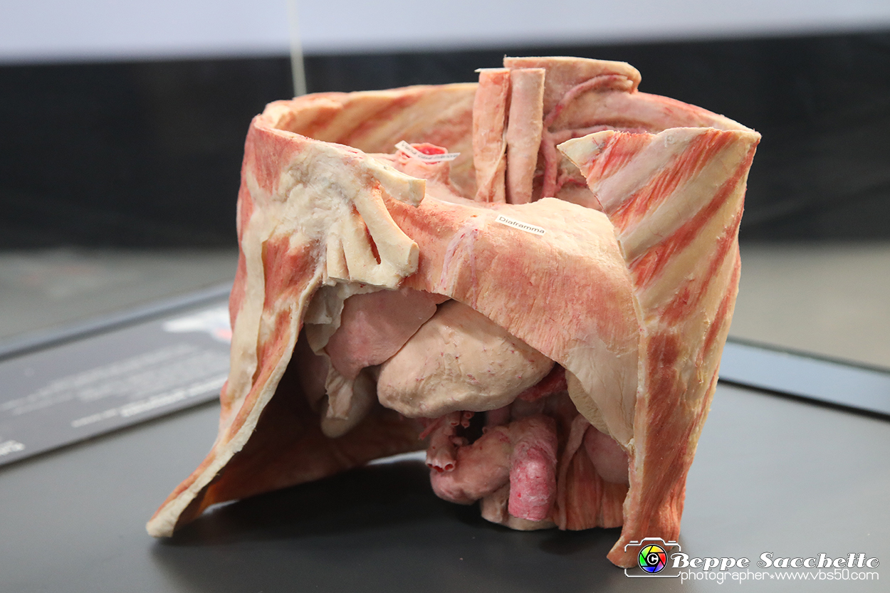 VBS_2646 - Torace con diaframma - Mostra Body Worlds.jpg